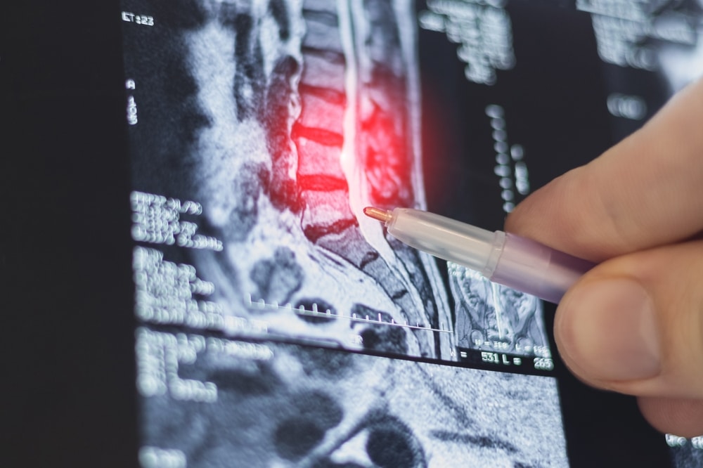 DoctorLearnMagneticResonanceImageOfHumanSpineMriOf