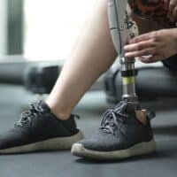 ProstheticArtificialLegWomanWithProstheticLegUsingWalkingOn