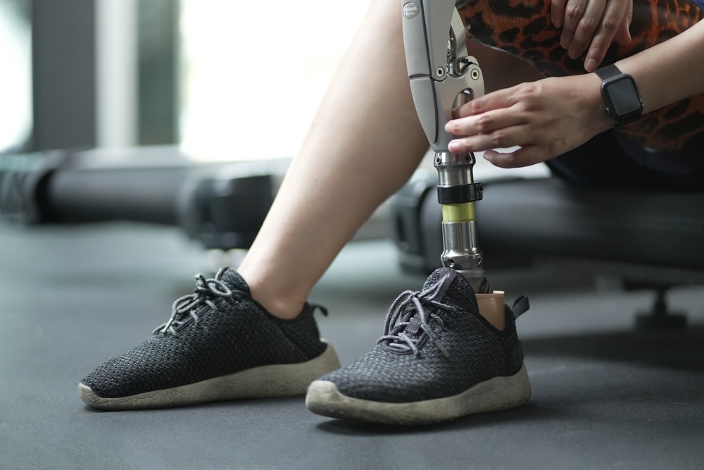 ProstheticArtificialLegWomanWithProstheticLegUsingWalkingOn