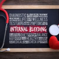 InternalBleedingGeneralHealthWordCloudOnChalkboardWithStethoscope InternalBleedingGeneralHealthWordCloudOnChalkboardWithStethoscope