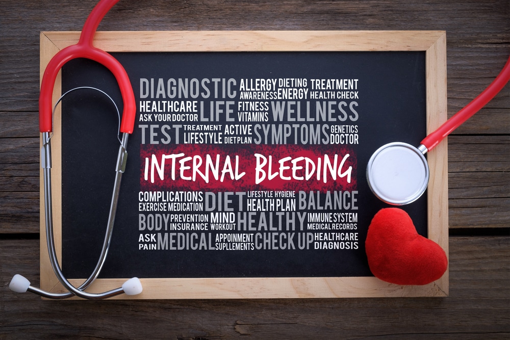 InternalBleedingGeneralHealthWordCloudOnChalkboardWithStethoscope